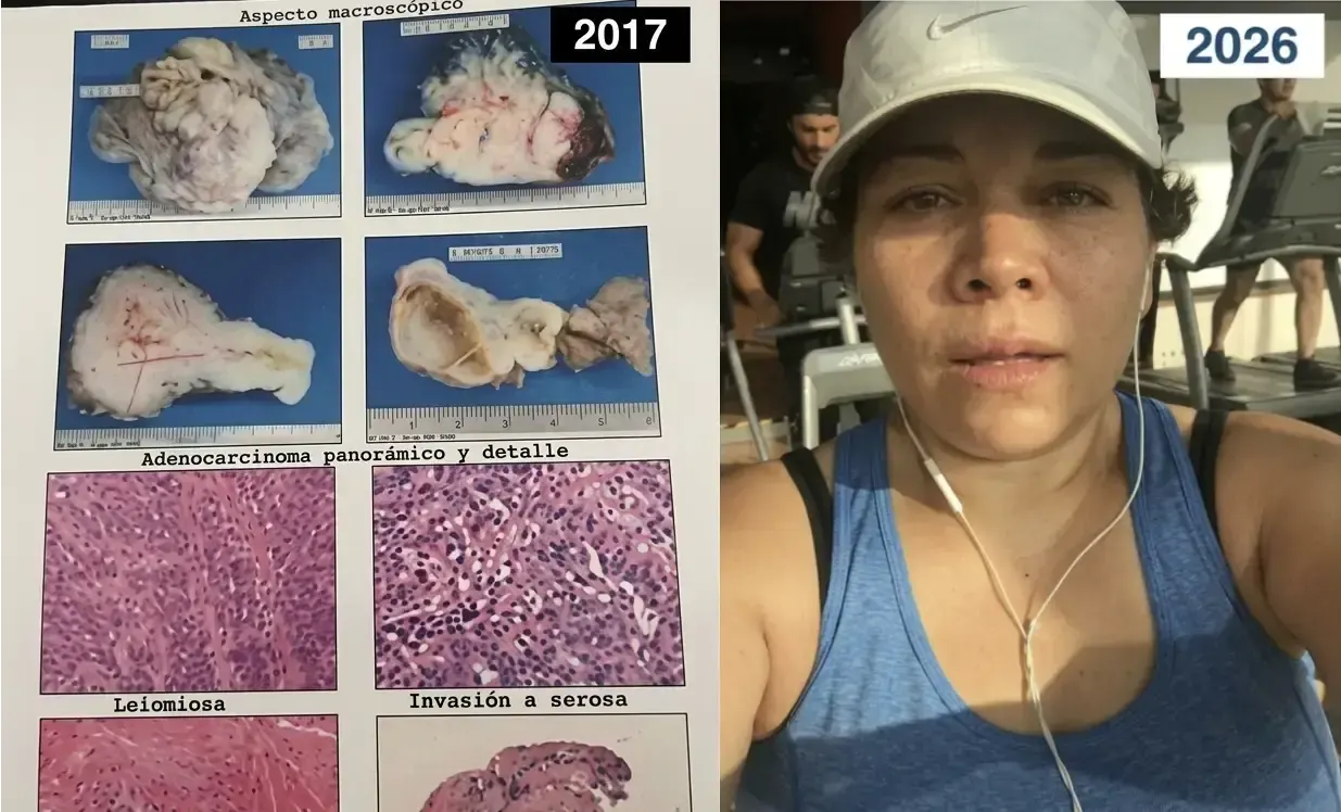 Fotografías clínicas de Marisol de 2017 y 2026